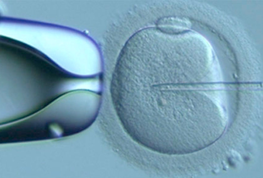 Piezo-ICSI – a new way of fertilising eggs